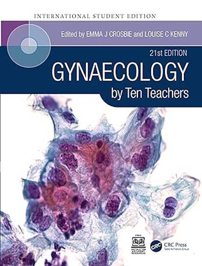 GYNAECOLOGY BY TEN TEACHERS