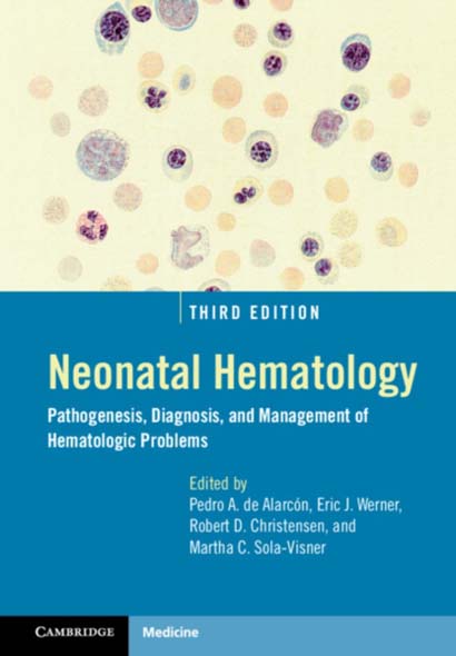 NEONATAL HEMATOLOGY  PATHOGENESIS DIAGNOSIS AND MA