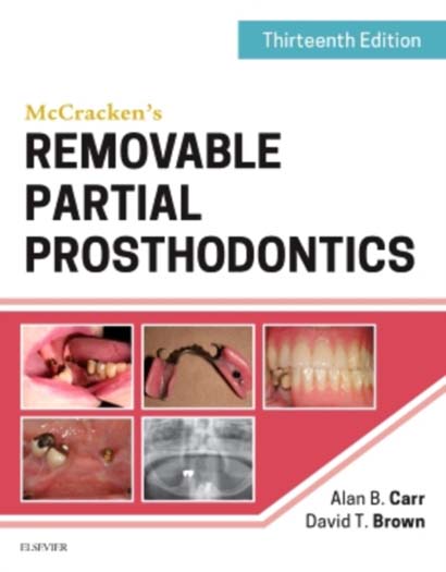 MCCRACKENS REMOVABLE PARTIAL PROSTHODONTICS-CARR ALAN