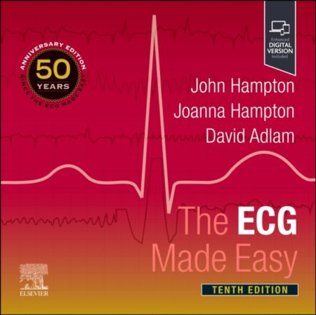 THE ECG MADE EASY