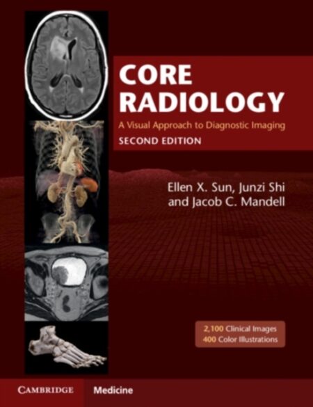 Core Radiology a Visual Approach to Diagnostic Imaging